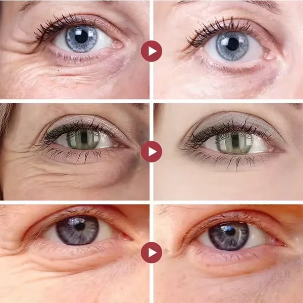 Instant-Eye-Bag-Remove-Cream-Retinol-Anti-Wrinkle-Firming-Skin-Fade-Fine-Lines-Anti-Dark-Circle.png